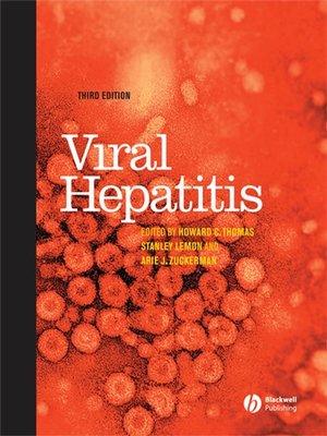 cover image of Viral Hepatitis